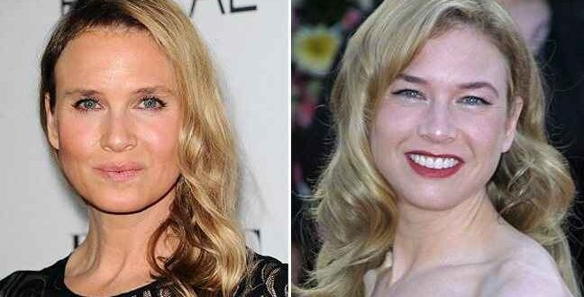 Κι όμως είναι η Renee Zellweger