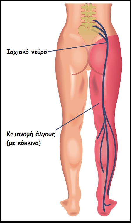 endomitriosi