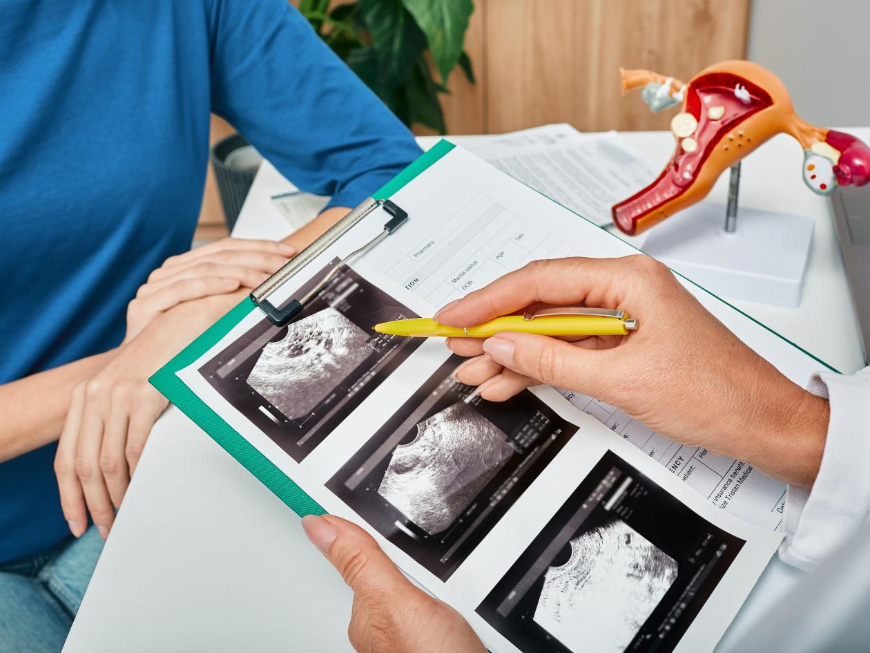 Gynecologist Showing To Woman Ultrasound Of Her Ovaries During Female Patient Visit To Gynecology Fo