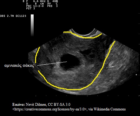 iperixografima2