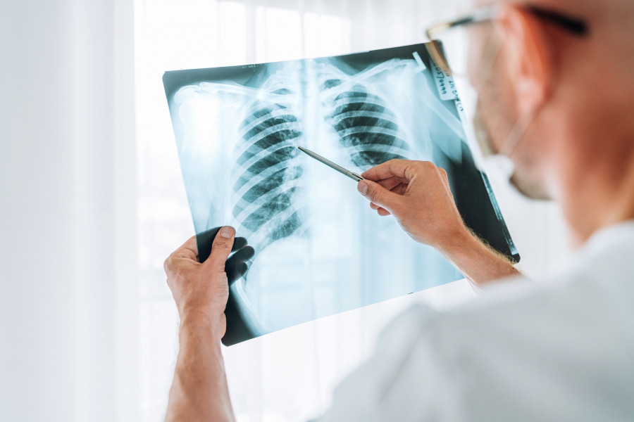 Chest-X-ray-Lungs-Scan-Radiology